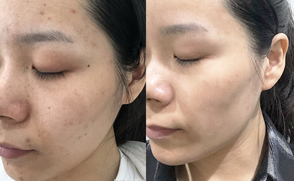 白瓷娃娃疼嗎？