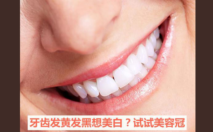 牙齒美容冠大約多少錢？牙齒美容冠怎么做的？