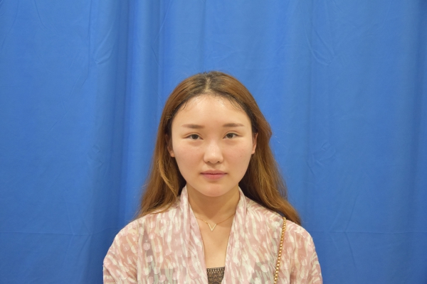 雙眼皮修復(fù)