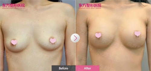 廣西南寧東方整形圓形效果