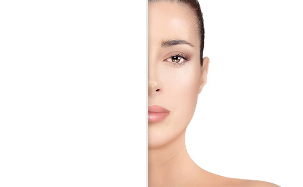 唐山金榮自體脂肪豐額頭有什么優(yōu)勢?自體脂肪豐額頭效果