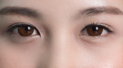 上眼皮松弛是什么原因引起的？