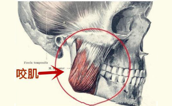咬肌肥大不用怕，5招教你輕松瘦咬肌