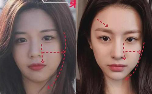 怎么有效的瘦臉？