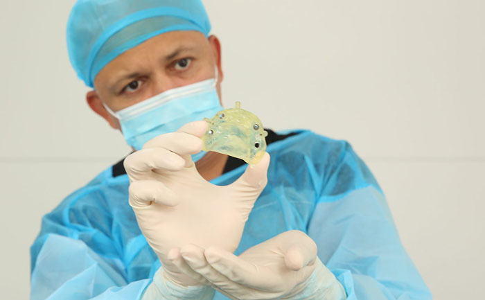 貴金屬烤瓷牙有哪些？貴金屬烤瓷牙的種類