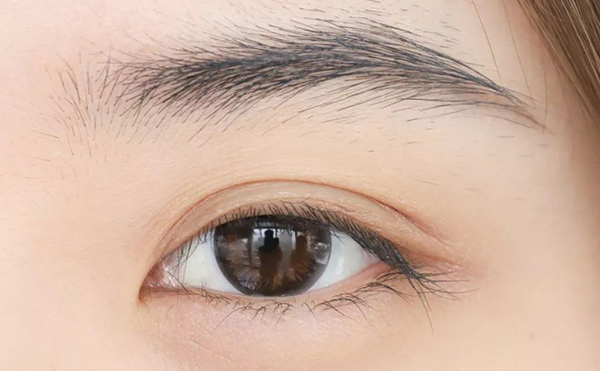 如何判斷單眼皮和內雙?單眼皮和內雙怎么變成雙眼皮?