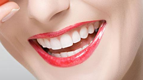 隱形牙套矯正要多久？