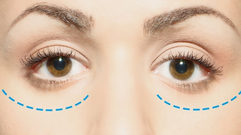 先天性突眼怎么辦？