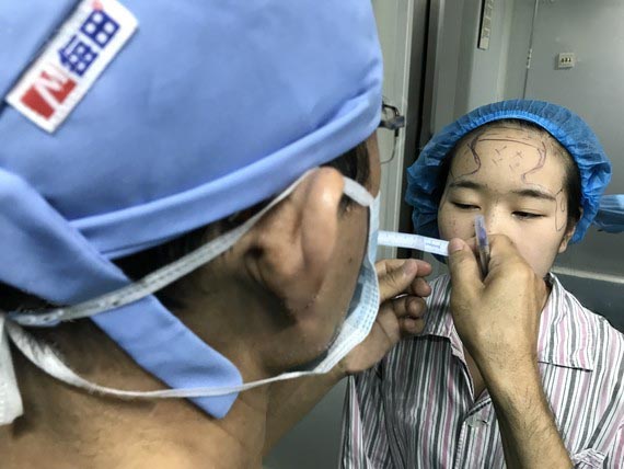 面部填充效果對(duì)比圖