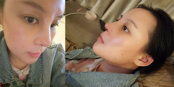 太原時(shí)光整形醫(yī)院案例1