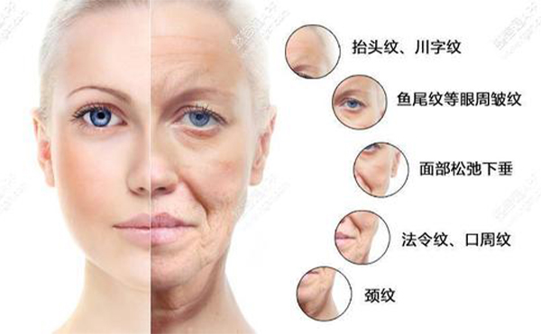 線雕的好處有哪些？