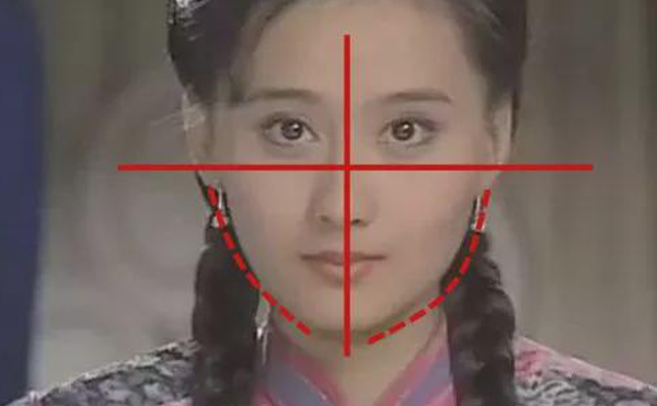 歪鼻矯正手術(shù)前后注意事項(xiàng)