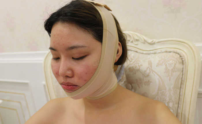 面部吸脂修復手術多少錢？面部吸脂會反彈嗎？