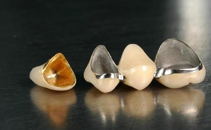 全瓷烤瓷牙多少錢一顆2021？全瓷牙可以用多久？