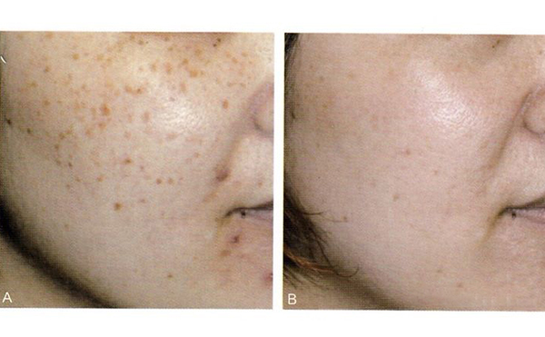 復合彩光效果怎么樣？