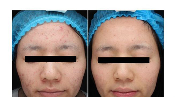 復(fù)合彩光安全嗎？