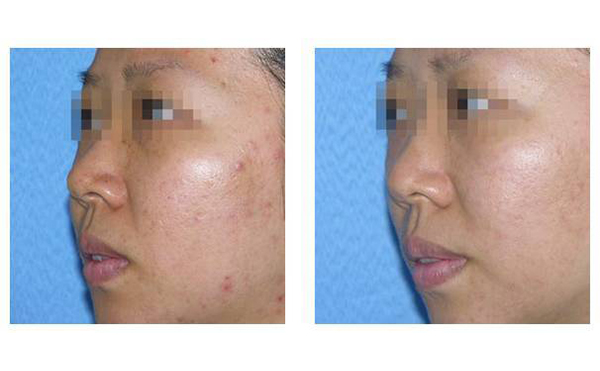 復(fù)合彩光多少錢？