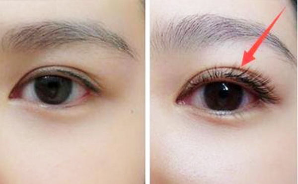 濃密的睫毛簡直就是大眼必備，濃密又卷翹的睫毛可以讓眼睛看起來更加有神亮眼，成功化身“睫毛精”。但是不少人睫毛稀疏、塌睫毛、夾不翹睫毛，有些小仙女的睫毛還特別雜亂，并不美觀，無睫毛星人該如何拯救顏值。倒睫與亂睫的區(qū)別是什么?倒睫與亂睫怎么辦?