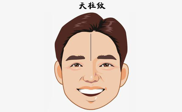 硅膠填充額頭安全嗎？