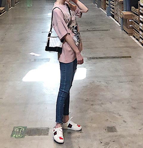 大腿吸脂術(shù)后效果反饋