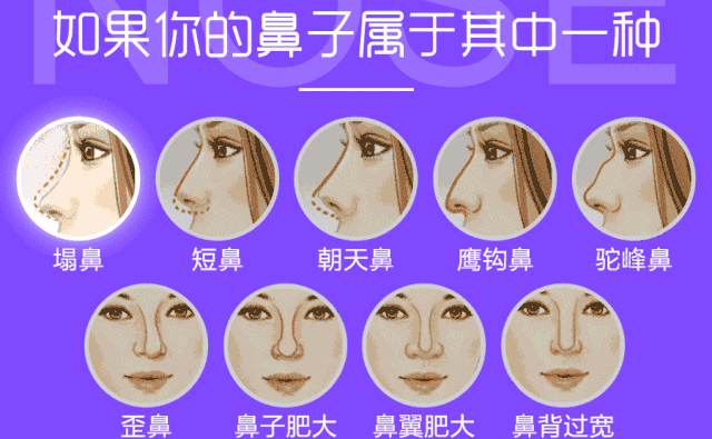 自體脂肪隆鼻可以保持多久？