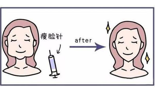 瘦臉針有什么功能？