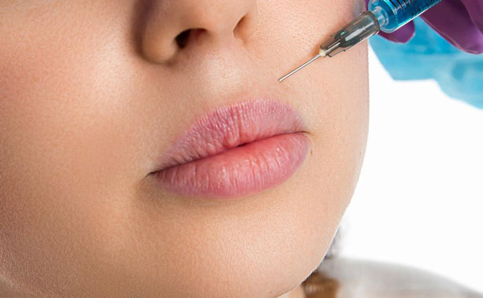 注射除皺針的注意事項有哪些？