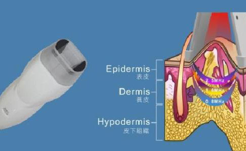 射頻除皺的效果好嗎？