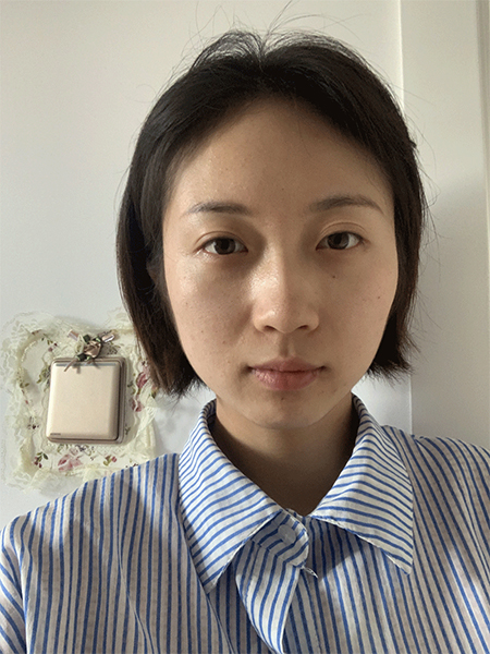 水光針注射效果圖1