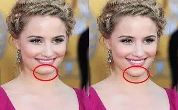 下巴美學標準是什么？