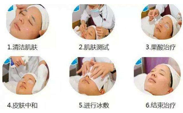 果酸煥膚的過程是什么？