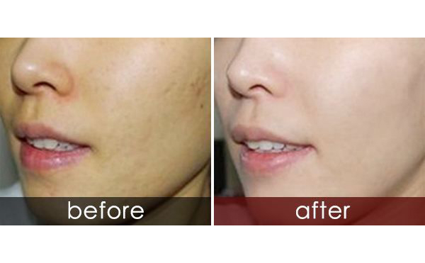 白瓷娃娃適合人群有哪些？