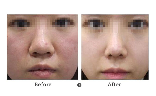 做黑臉娃娃前要注意什么？