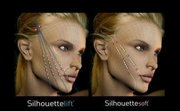 面部線(xiàn)雕后臉變形了是什么原因?還能恢復(fù)嗎?