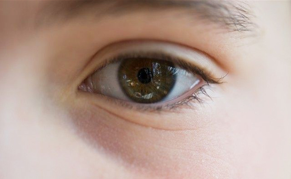 淚溝是怎么形成的?淚溝怎么才能消除?