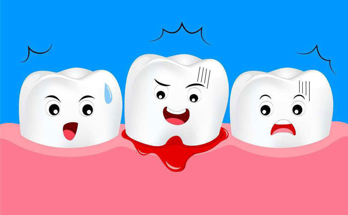 如何快速消腫牙齦腫痛