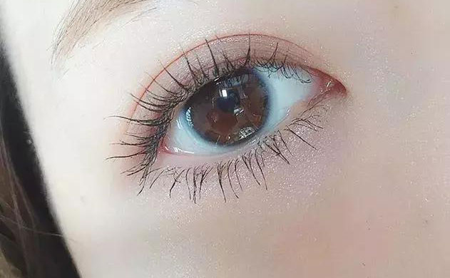 激光雙眼皮手術(shù)多少錢？激光雙眼皮手術(shù)需要多久恢復(fù)時間？