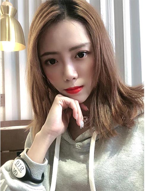 肋軟骨鼻綜合案例:術(shù)后效果2