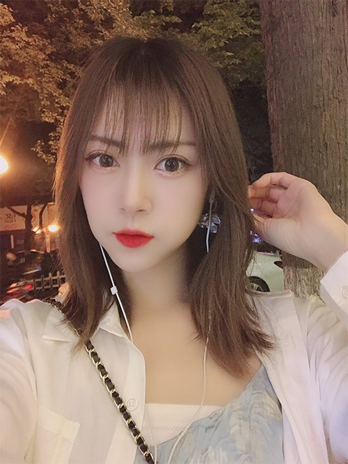 天津伊美爾超肋鼻綜合案例兩個月后效果圖