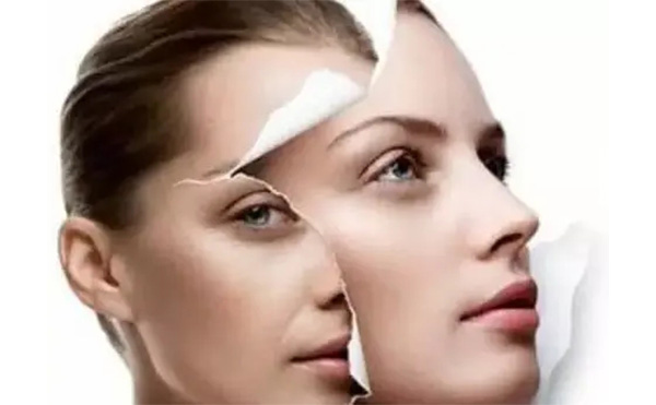 做臉部整容術(shù)多少錢?受哪些因素影響?