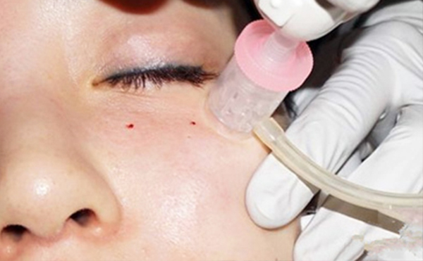 水光針和皮秒哪個(gè)好？