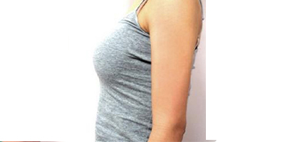 水動力吸脂術(shù)后