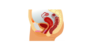 G點注射術(shù)前