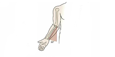 肘外翻矯正術(shù)前