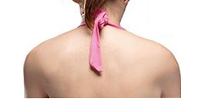 肩膀吸脂術(shù)前