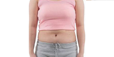 動氧瘦腹部術(shù)前