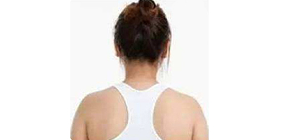 熱立塑術(shù)前