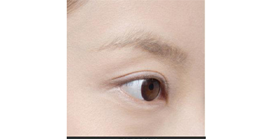 種植睫毛術(shù)前