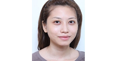 玻尿酸墊下巴術(shù)前