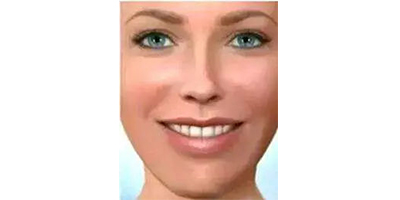 頜面正畸術(shù)后